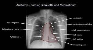 Maybe you would like to learn more about one of these? Chest X Ray For Students How To Interpret And Present Methodically Andreas Astier