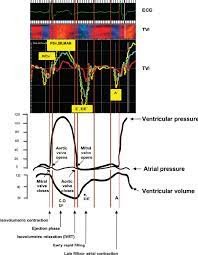 It was the most watched channel in portugal from 2005 to 2019. The C Echo And Tvi Parameters Measured In The Cardiac Cycle Cardiac Download Scientific Diagram