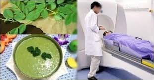 Loại rau phá hủy hơn 90% tế bào UT trong vòng 48h mà người Việt cứ ngỡ là  rau dại mọc đầy đường👇