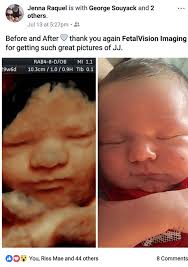 We did not find results for: 3d Ultrasound 4d Ultrasound Philadelphia Pa New Jersey