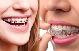 New Advancements | Metal Braces & Invisalign | Orthodontist Johnstown