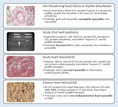 Chapter contents show symptoms of acute pericarditis/myocarditis ecg changes in acute pericarditis, myocarditis, perimyocarditis 9 Clinical And Histological Phenotypes Of Myocarditis And Inflammatory Download Scientific Diagram