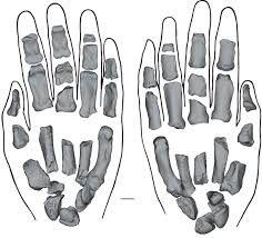 Image result for Aurora White 2010 HS