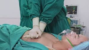 The magical defibrillator trope as used in popular culture. Heart Electric Shock Stock Video Footage 4k And Hd Video Clips Shutterstock