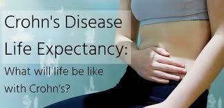 Crohn S Disease Life Expectancy Will Your Life Be Shorter Home Remedies For Heartburn Crohns Disease Gassy Stomach