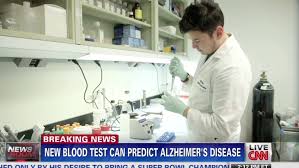 Image result for alzheimer's blood test