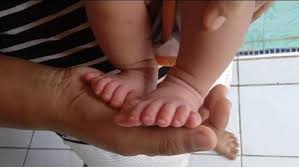 Jul 01, 2021 · video viral tawaran mc diduga arisan sosialita pakai tumbal berondong di pondok indah perempuan itu menceritakan apa yang ia alami dilengkapi dengan tangkapan layar percakapannya saat ditawari menjadi mc. Viral Kakak Adik Galuh Dan Galih Asal Indramayu Punya 12 Jari Tangan Dan Kaki Bagian 1