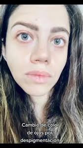 Clinica Egos Barcelona