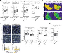 Confocal and 2d sted imaging of dendrites in brain slices. Control Of Endothelial Cell Polarity And Sprouting Angiogenesis By Non Centrosomal Microtubules Elife