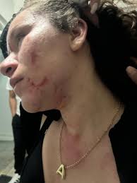 Circulan en redes sociales videos de altercado protagonizado por María  Elena Ríos en el Hospital Reforma