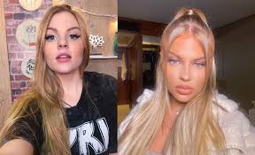 We did not find results for: 6 Famosas Que Fizeram Harmonizacao Facial Antes E Depois