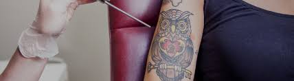 Tattoo removal cost richmond va furthermore nearsay c 93790 40582 get ready for wedding season summer 2016 schedule your laser tattoo richmond, va 23294 get directions. Tattoo Removal Impulse Skin Laser Richmond S Premier Spa