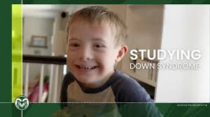 CSU-led $6.2M study to identify, improve interventions for young children  with Down syndrome