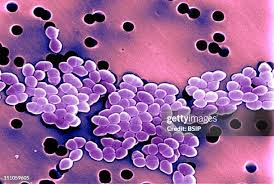 Image result for Group D Streptococcus
