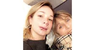 Mordue par un chien avant Koh Lanta, Cindy a eu la peur de sa vie