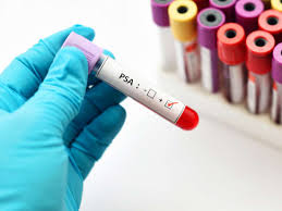 Epstein Barr Virus Test Procedure Results And Interpretation