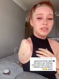 Person with Stump Arms