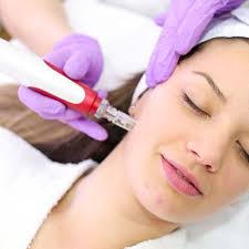 Curso de Dermapen (En linea)