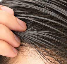 خطوات للتخلص من الشعر الدهني نهائيا Get Rid Of Oily Hair موقع جمالك