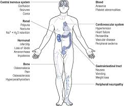 End stage renal disease used to be a disease of younger patients due. Chronic Kidney Disease And End Stage Renal Disease Clinical Gate