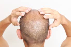 Top 5 rosemary oil benefits. Rosemary Oil For Hair Growth 2021 Guide Hairguard
