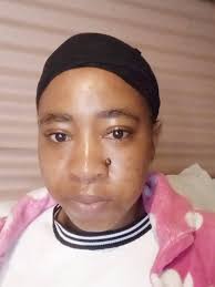 Neora's Neo-FILLER is delivering remarkable results once again! With  consistent daily use over just 5–9 weeks, the transformation speaks for  itself. While individual results may vary, many users experience visible,  noticeable improvements—especially