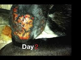 View an illustration of picture of black widow spider bites and learn more about skin problems and treatments. Venomous Spider Bite Healing Progression Youtube