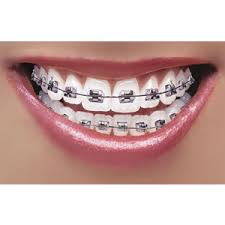 However, it is an effective way to keep your teeth clean and white with braces. Weight Loss And Fitness How To Whiten Teeth With Braces