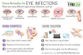 Home Remedies For Eye Infections Top 10 Home Remedies Allergy Remedies Stuffy Nose Remedy Natural Headache Remedies