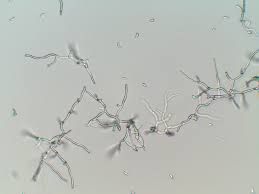 Image result for Pseudobromus