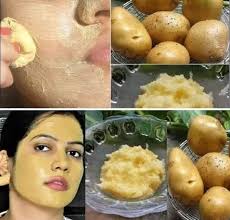 ✓Resèt natirèl pou elimine Tach Nwa , bouton sou po'w nan vizaj ou:  👉Pataje ! Pataje ! Pataje pou ede yon lòt moun , sispann achte krèm dekale  figi'w kap vin ba'w