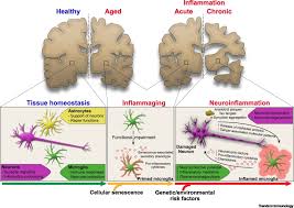 Children will learn colors through a collection of preschool color worksheets that involve matching, drawing, recognition and of course coloring. Neuroimmune Connections In Aging And Neurodegenerative Diseases Trends In Immunology