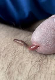 Urethral stuffing hole rubber worm - high definition fetish scenes