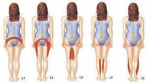 Spitalizarea este de regulă de o noapte postoperator, însă la domiciliu va continua un program de exerciţii fizice de intensitate progresivă. Hernia De Disc Hernia De Disc Kinetoterapie Acasa Craiova Facebook