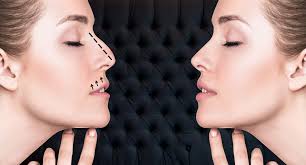 🥇 Dr. Ben Talei Facial Plastic Surgeon Serving Beverly Hills, Los Angeles,  Santa Monica