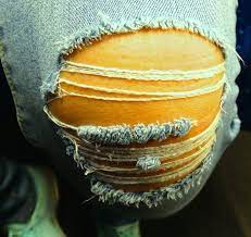 We did not find results for: Arti Kedutan Di Lutut Kanan Benarkah Pertanda Akan Timbulnya Pertikaian Tribun Batam