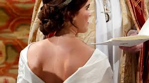 (we are not affiliated with eugenie, her family or. Casamento Real Por Que A Princesa Eugenie Escolheu Um Vestido Que Deixava Sua Cicatriz A Mostra Bbc News Brasil