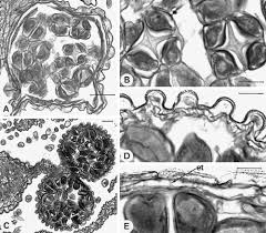 Image result for Stanfieldiella imperforata