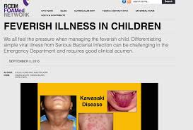 Image result for Fever Without Focus Red Flags