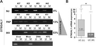 What to know about bladder cancer. Epigenetic Inactivation Of St6gal1 In Human Bladder Cancer Bmc Cancer Full Text