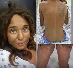 Bear rescued from plastic jar stuck