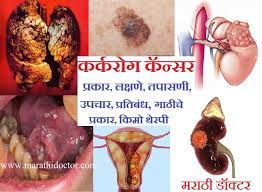 A large, discolored lesion on the chest of a person with hansen's disease. à¤•à¤° à¤•à¤° à¤— à¤• à¤¨ à¤¸à¤° à¤ª à¤°à¤• à¤° à¤²à¤• à¤·à¤£ à¤¤à¤ª à¤¸à¤£ à¤‰à¤ªà¤š à¤° à¤ª à¤°à¤¤ à¤¬ à¤§ Cancer In Marathi