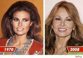 Chatter Busy Raquel Welch Plastic Surgery Raquel Welch Rachel Welch Raquel Welch Today