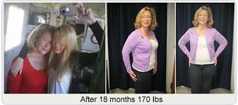 Gastric bypass before after pictures. Before After Pictures Testimonials Gastric Bypass Before After Testimonials After Obesity Surgery San Francisco California