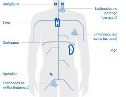 Entretanto, enquanto a leucemia tem origem na medula óssea, o linfoma surge no sistema linfático, uma rede de pequenos vasos e gânglios linfáticos, que é parte tanto do sistema circulatório, como do sistema imune. Linfoma Nao Hodgkin Lnh