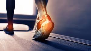 Image result for Leg Pain