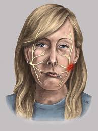 Pin On Face Anatomy