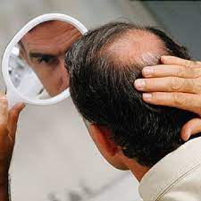 There are ways of slowing hair loss, one being keeping blood sugars at goal. Can Obesity Cause Hair Loss Ahs India