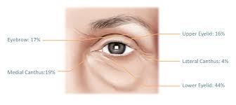 The strongest risk factor for developing skin cancer is ultraviolet (uv) ray exposure, typically from the sun. Eyelid Cancer Newport Beach Melanoma Removal Orange County