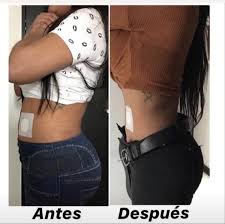 😱 LLEGARON LOS PARCHES PARA PERDER PESO 😉 🔝 OLVÍDATE DE ESOS KILITOS DE  MAS 🔝 🌸✨SLIMPATCH✨🌸 •Slim Patch posee principios activos de hierbas  naturales y propiedades biomágneticas. •funciona como motor gastrointestinal